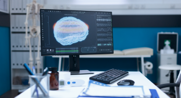 МРТ головного мозга