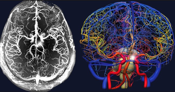 мрт-контраст.jpg мрт головного мозга с контрастом в Минске