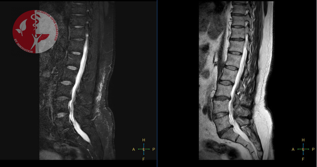 МРТ позвоночника в Минске МРТ позвоночника в Минске